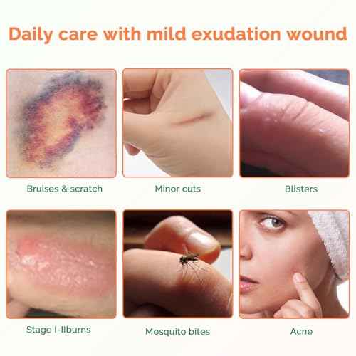 Extra Thin Hydrocolloid Bandages 10 Pack 3" x 3" Large Wound Care Dressing Self Adhesive Big Waterproof Hydrogel Patch Bandaids Healing for Burn Blister Bedsore Acne Care