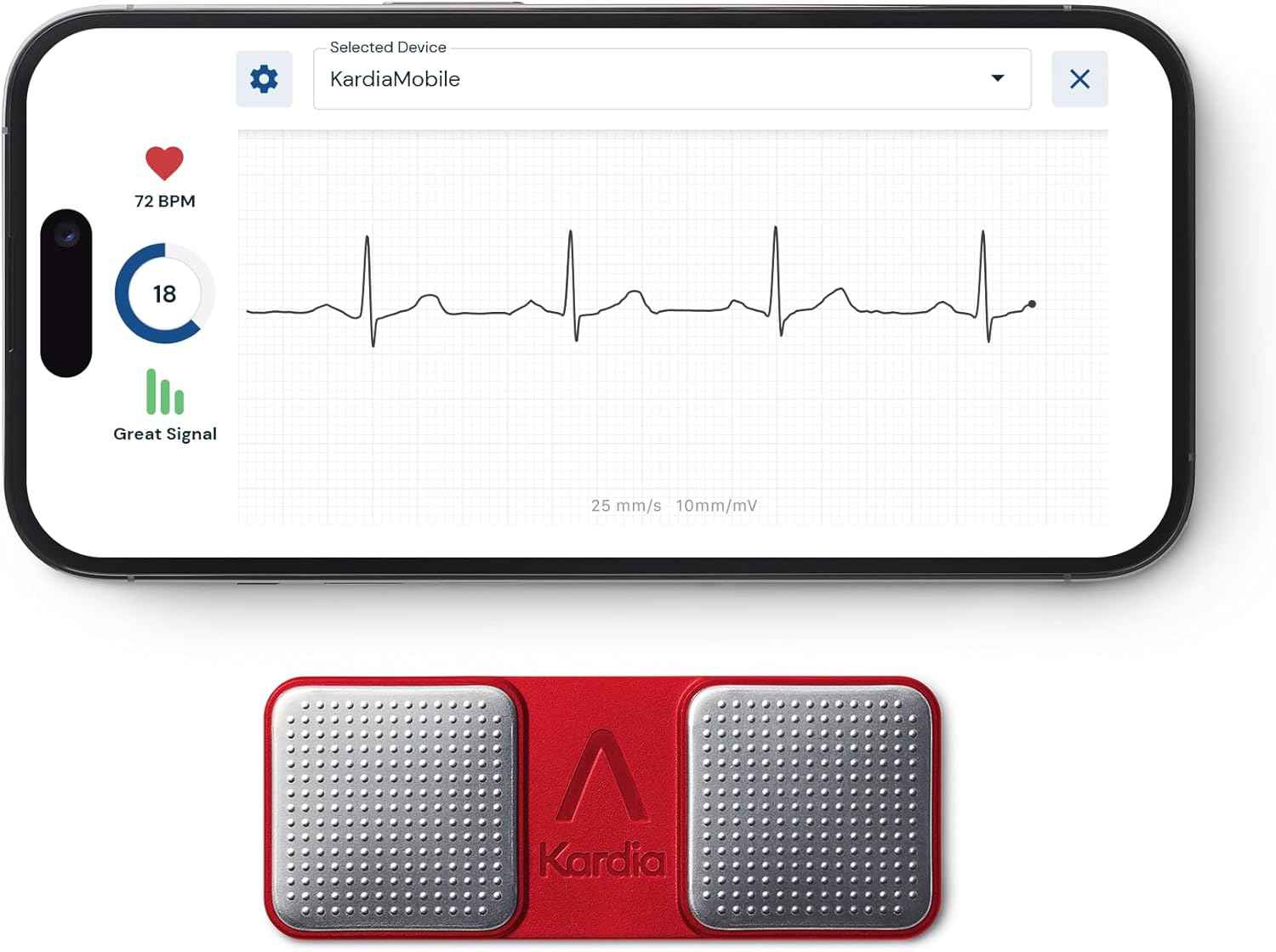 KardiaMobile EKG Monitor – At-Home Heart Rhythm Tracker for AFib & Arrhythmias – Quick 30-Second Results, Compatible with Most Smartphones