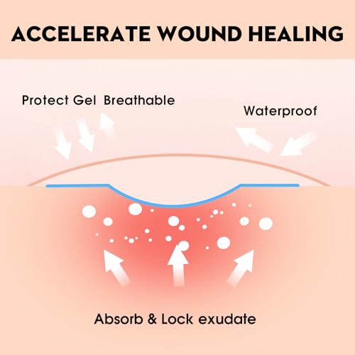 4x4 Inch Hydrocolloid Wound Dressings - 12 Pack Waterproof Skin Bandages - Light Exudate Care