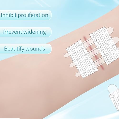 Wound Closure Strips Zip Stitch Sutures Butterfly Bandages Kit 6x8cm Emergency Laceration