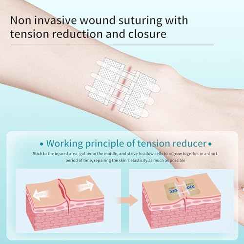 Wound Closure Strips Zip Stitch Sutures Butterfly Bandaids Emergency Laceration Closure Kit for Lacerations Incisions Cuts(6X8CM)