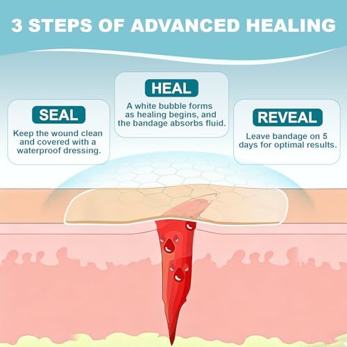 Large Hydrocolloid Wound Bandages - Waterproof, Fast Healing, 15 Count