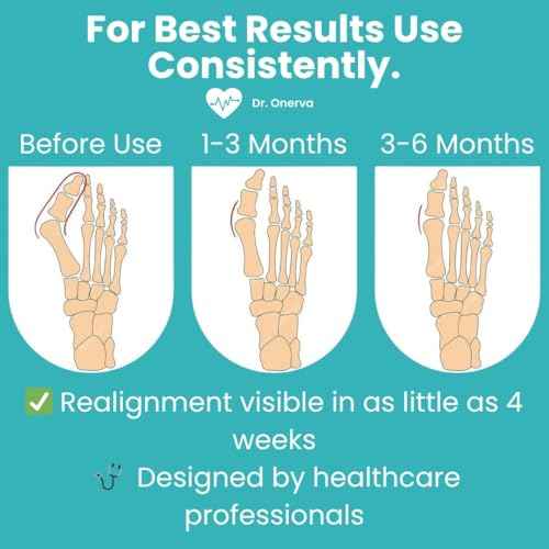 2PC Bunion Corrector for Women & Men ? Toe Straightener Socks for Hallux Valgus, Pain Relief, Non-Slip, Breathable, Day & Night Use, Washable, L/R Foot Set