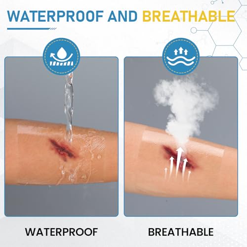 80 Packs Transparent Film Dressing 4" x 4.75", Waterproof Bandages for Wounds, Wound Dressing for Shower or IV Shield, Tattoo Aftercare Bandage, Clear Bandages for Wound Care