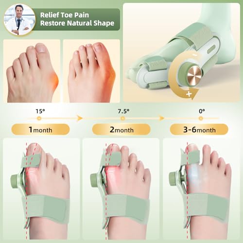 Bunion Corrector for Women Men Big Toe, Adjustable Knob Double Correction Bunion Fix Relief Bunion Splints with 3 Different Angle Fixing Plates Silicone Pad Comfortable Effective