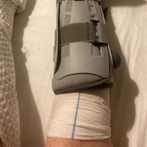 Tubular Bandage Cast Sleeve Roll Comfortable Cast Stockinette Tubular Arm Stocking for Prewrap Under or Over Cast Bandages (7.5cm x 5m)