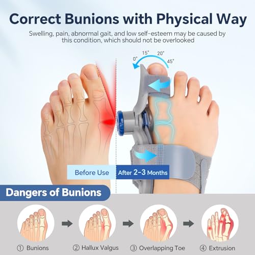 Bunion Corrector for Women & Men ? Single Toe Straightener with Adjustable Alignment Knob & Silicone Pad, Day & Night Use, Fits Left or Right Foot
