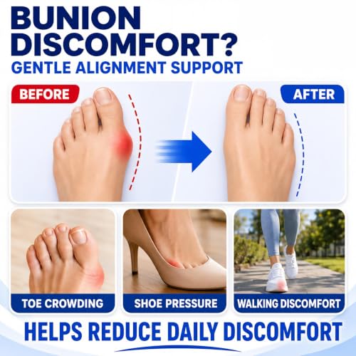 Bunion Corrector Kit for Women & Men with Toe Separator Arch Support Gel Pad - Day & Night Relief, Adjustable Hallux Valgus Splint - Variation 1
