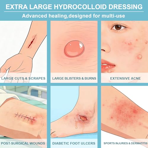 Large Hydrocolloid Wound Bandages - Waterproof, Fast Healing, 15 Count