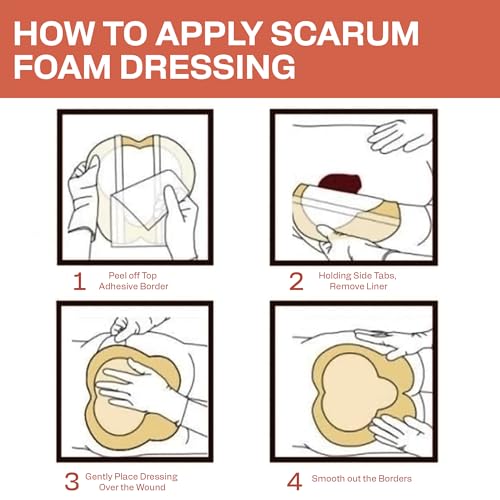 Sacrum Silicone Foam Wound Dressing 9x9 Inch Pack of 5 - Border Medical Gauze