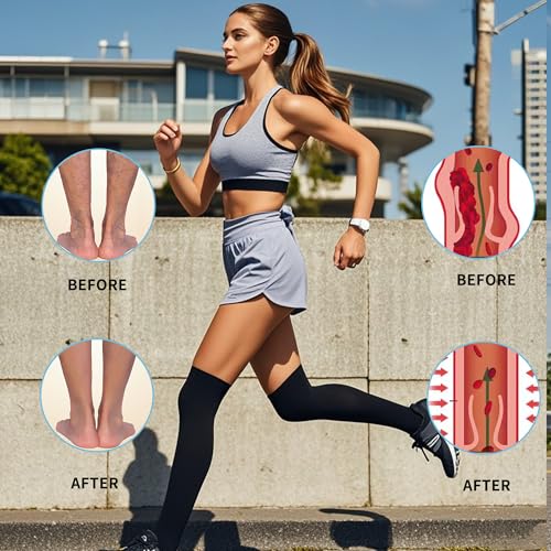 Large Open Toe Thigh High Compression Socks Women 20-30 mmHg Black