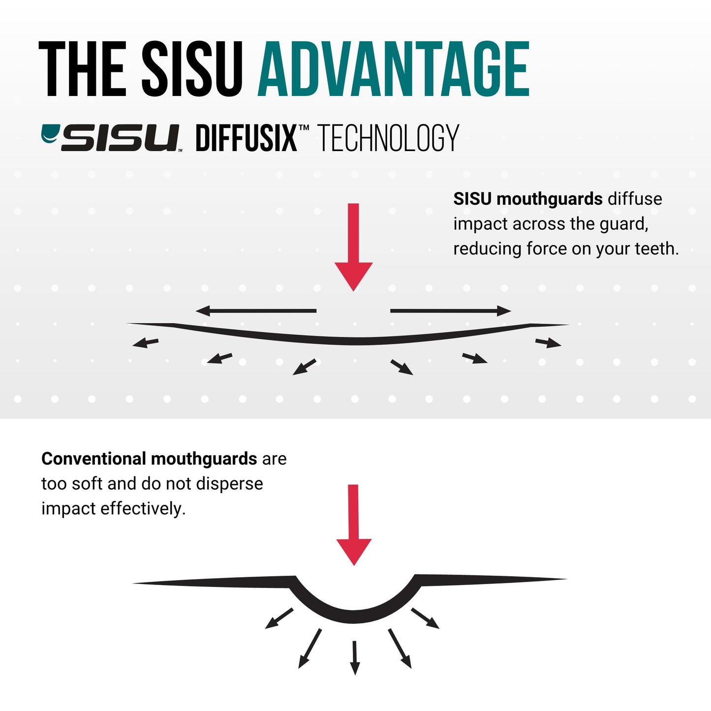 SISU Aero Medium Mouthguard, Charcoal Black - 30% Stronger Protection for Lacrosse, Football, Hockey, Roller Derby, Team Sports - Remoldable Up to 20 Times - Ultra Slim - Works for Braces - Non Toxic
