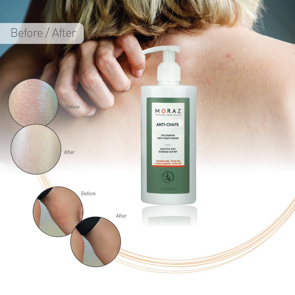 Moraz New Polygonum Anti Chafe Cream, 8.5 FL.OZ. Suitable for Men and Women, Great for Soldiers and Athletes