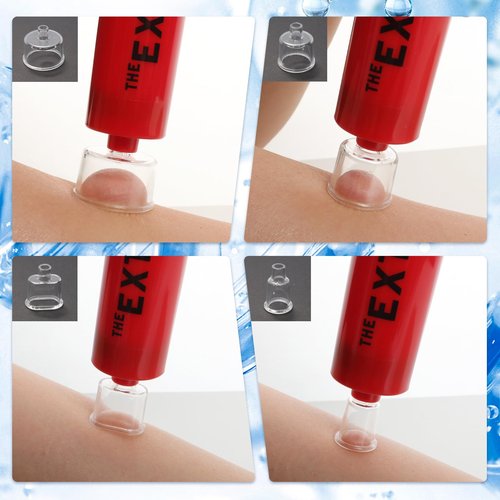 Gvhntk Snake Bite Kit Sting Kit Venom Extractor Suction Pump Emergency Sting Bite Kit First Aid Supplies for Backpacking Camping and Hiking (Red)