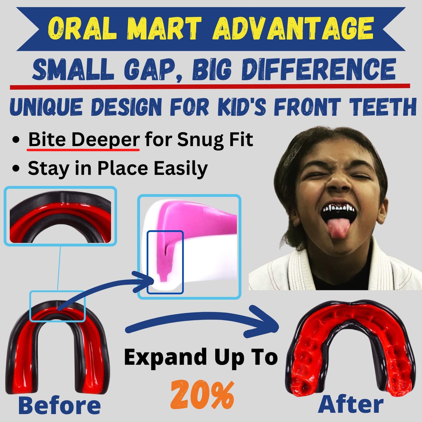 Oral Mart White/Pink Youth Mouth Guard for Kids - Youth Mouthguard for Karate, Flag Football, Martial Arts, Taekwondo, Boxing, Football, Rugby, BJJ, Muay Thai, Soccer, Hockey