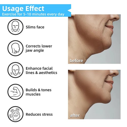Motspo Jaw Exerciser for Men & Women - 4 Resistance Levels (8PCS) Silicone Jawline Exerciser Shaper Jaw Line Trainer Strengthener, Slim & Tone Your Face