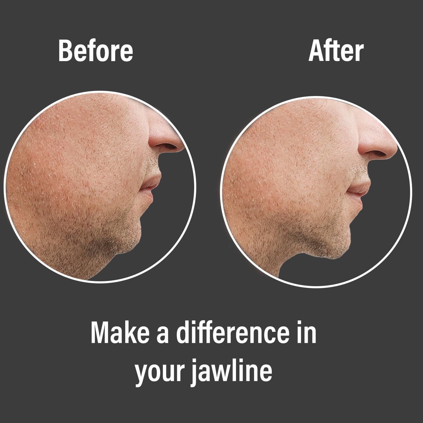 JawRx Jawline Exerciser, Double Chin Eliminator, Face Lift Device, Jaw Strengthener, 6 PCS Jawline Shaper for Men and Women, 3 Resistance Levels