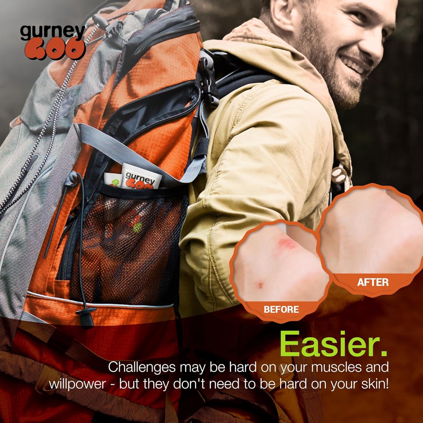 Anti-Chafing Cream with Tea Tree Oil for Men & Women - Blister & Pruning Relief